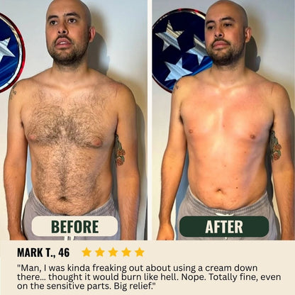 Before and after - Mark Y